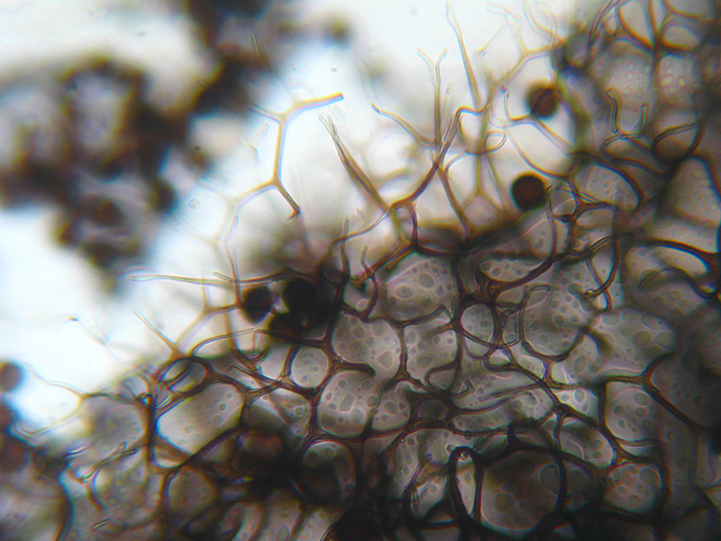 Lamproderma ovoideumechinulatum ?